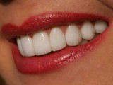 Способы укрепления зубной эмали